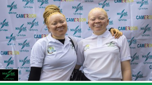 2025-international-Albinism-Day-in-Cameroon-3 (1)