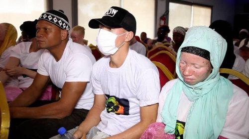 Discussion-regarding-the-condition-of-people-living-with-albinism-in-Senegal-led-by-our-representative-Mr.-Bamba-Diop