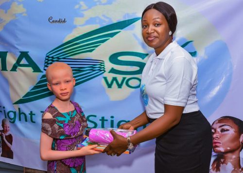 Little girl with albinism accepting school supplies for Back to School