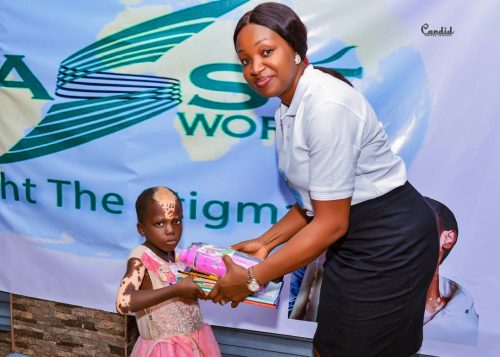 Little girl with vitiligo accepting school supplies for Back to School