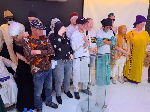 Mr.-Bamba-Diop-holding-a-press-conference-to-discuss-the-advancement-of-people-living-with-albinism-in-Senegal