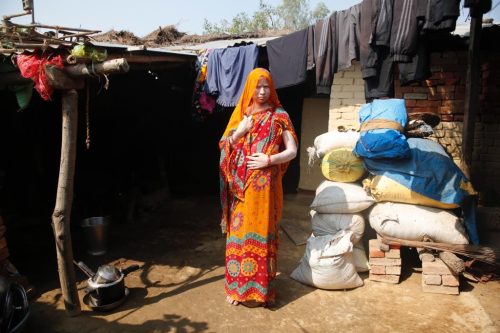 Outreach-Albinism-Nepal-2023-10