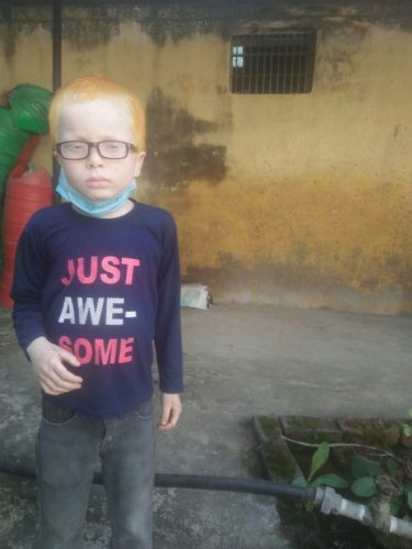 Outreach-Albinism-Nepal-2023-4