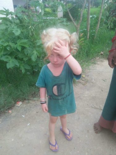 Outreach-Albinism-Nepal-2023-5