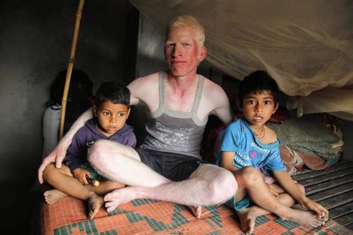 Outreach-Albinism-Nepal-2023