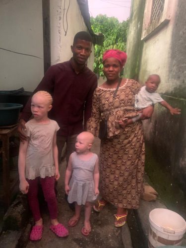 This-mother-shows-off-her-three-children-two-of-which-live-with-albinism-in-Cameroon