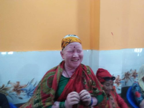 Woman-living-with-albinism-in-Nepal-