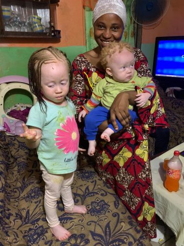 mother-of-two-proudly-showing-her-joy-has-she-is-raising-two-living-with-albinism-in-Cameroon